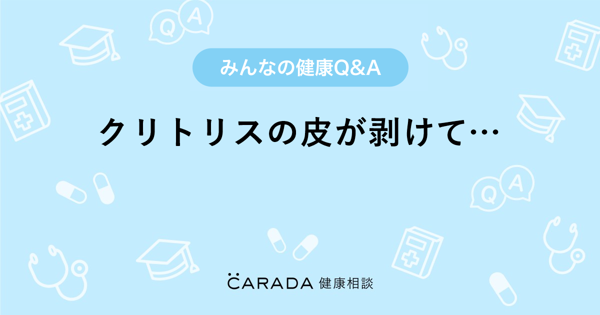 Amazon | クリの皮むき 栗の皮むき 夏みかんの皮もむける