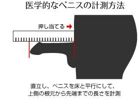 長茎治療（ペニスを長く）｜札幌中央クリニック