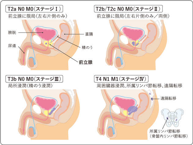 前立腺の大きさはどこからが正常？異常？泌尿器科が解説します - 医療法人神楽岡泌尿器科