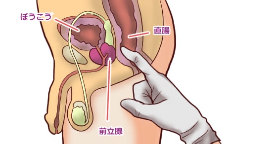 前立腺炎（慢性前立腺炎） | 慢性痛治療の専門医による痛みと身体のQ＆A