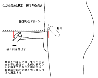 陰茎増大・ペニス増大｜西新宿杉江中央クリニック｜美容外科・形成外科