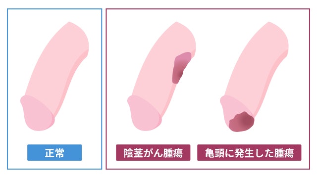 超初心者女性向け】おちんちんの具体的なさわり方と舐め方│