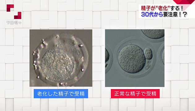 精子が寿命を迎える年齢とは ～精子“老化”の新事実～ - NHK クローズアップ現代