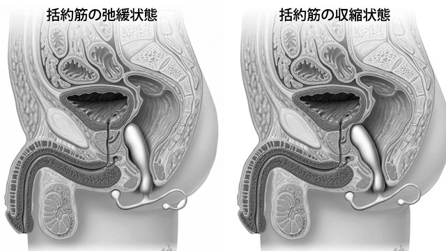 アラシキ] 尿道から前立腺グリグリする漫画。 |