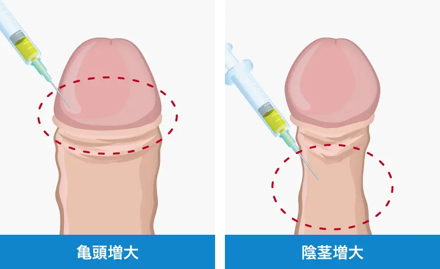 日本人ペニスの平均サイズと世界評価・女性が性交SEXに満足するちんこの大きさは？